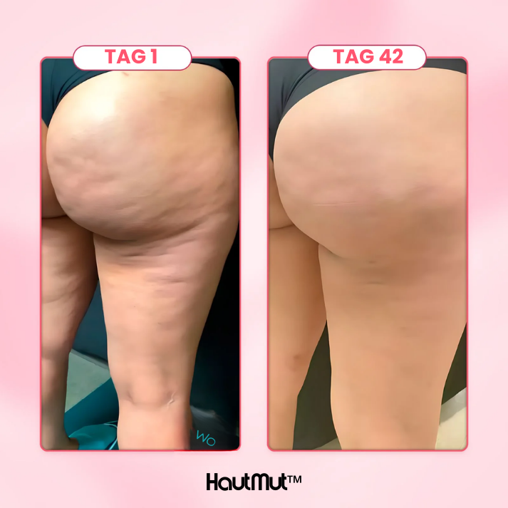 Hautmut™ Cellulite Behandlungskit